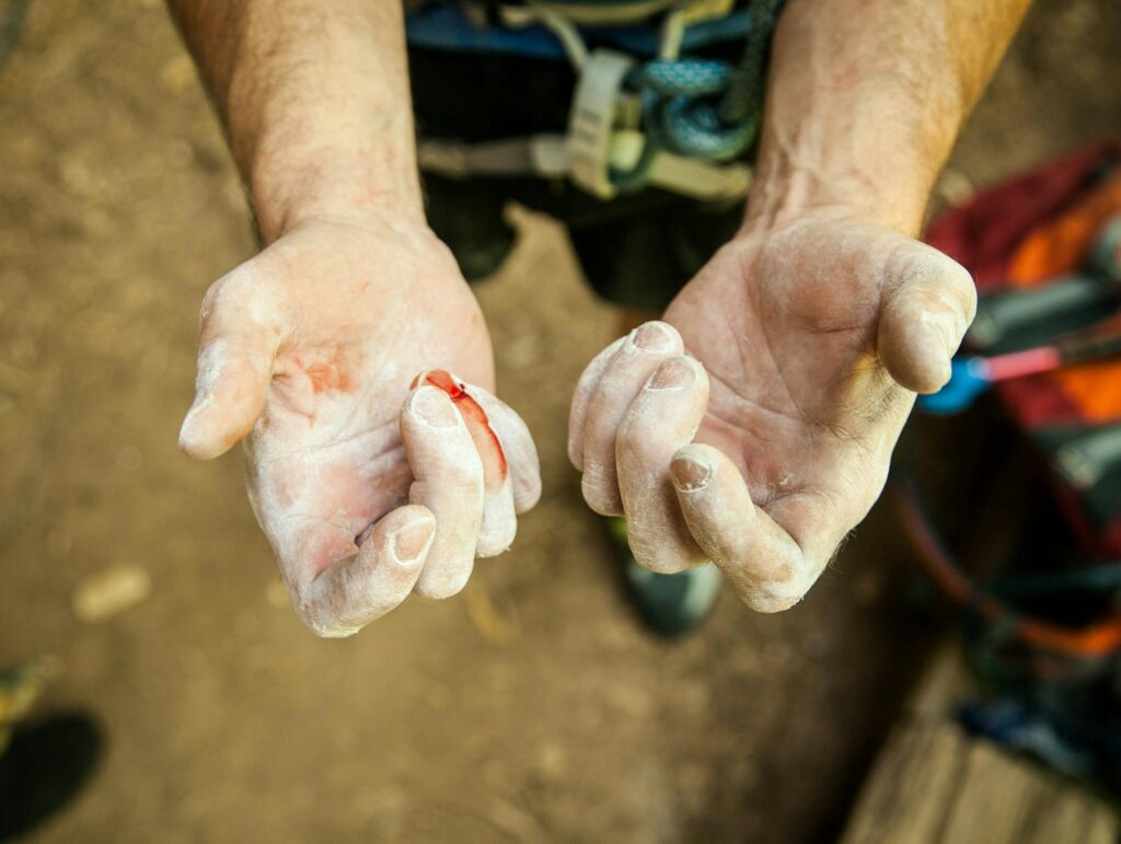 Picture of What Condition Causes Excessive And Prolonged Bleeding? – Health Prepper